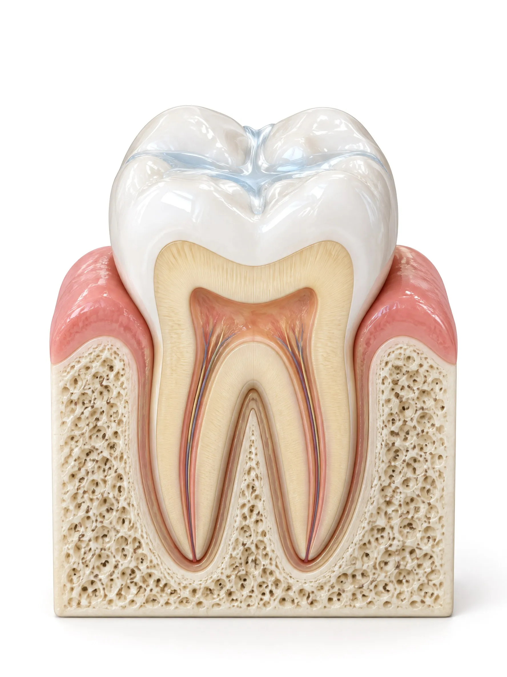 Cross section of a back tooth with a thin protective sealant covering the grooves of its chewing surface.