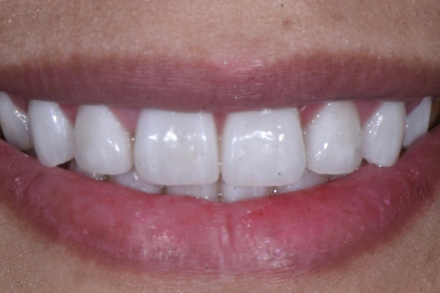 Royal Dental Center | Oral Cancer Screening, Dentures and Implant Restorations