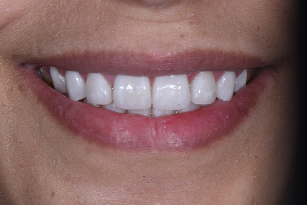 Royal Dental Center | Full Mouth Reconstruction, Pediatric Dentistry and Teeth Whitening