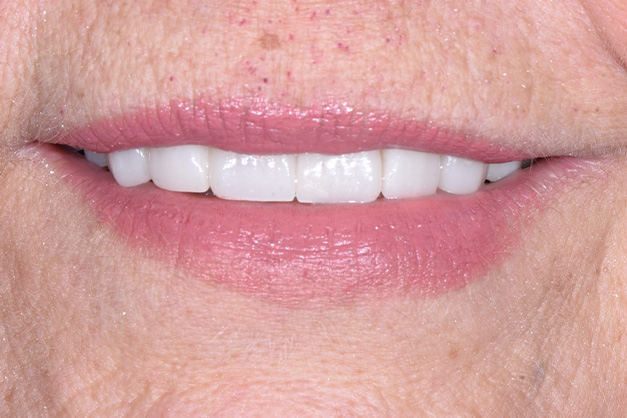 Royal Dental Center | Extractions, Dentures and Periodontal Treatment