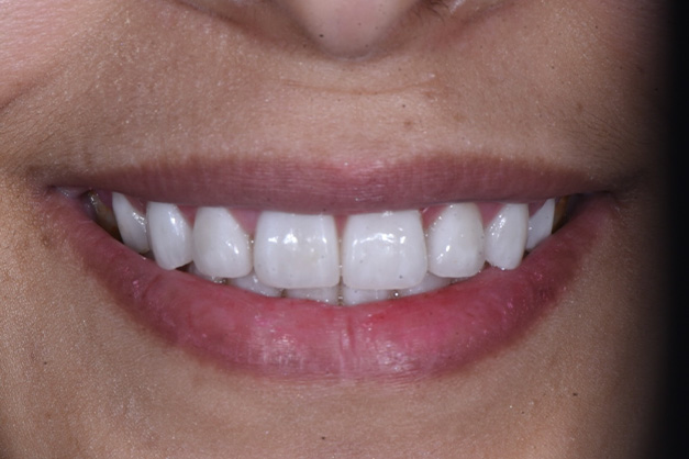 Royal Dental Center | Periodontal Treatment, Dental Fillings and Fluoride Treatment