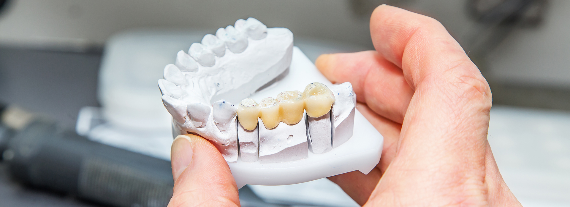 The image shows a person holding a set of teeth with their left hand, examining them closely.