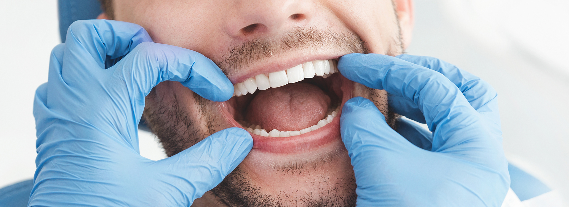 The image features a man with his mouth wide open, surrounded by medical professionals wearing gloves and a surgical mask, creating an impression of a dental or oral health care setting.